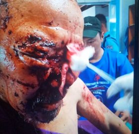 सोलुखुम्बुमा भालुको आक्रमणबाट बृद्ध गम्भिर घाइते