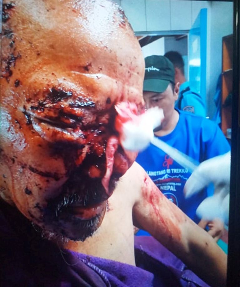 सोलुखुम्बुमा भालुको आक्रमणबाट बृद्ध गम्भिर घाइते