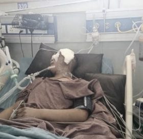 काठले लागेर गम्भिर घाईते सुदिप मगरको उपचारको क्रममा ज्यान गयो